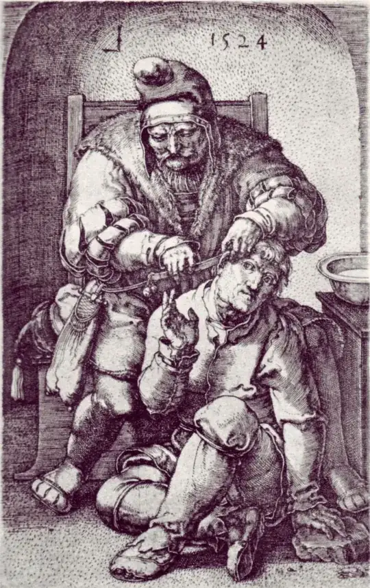 um desenho de um cirurgião operando um homem, passando uma lâmina atrás da orelha